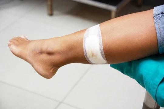 Wound Pros Arizona — photo 4