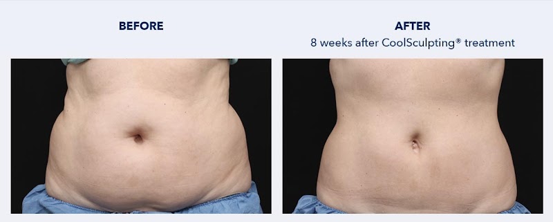 Premier Orthopedic PLLC — photo 4