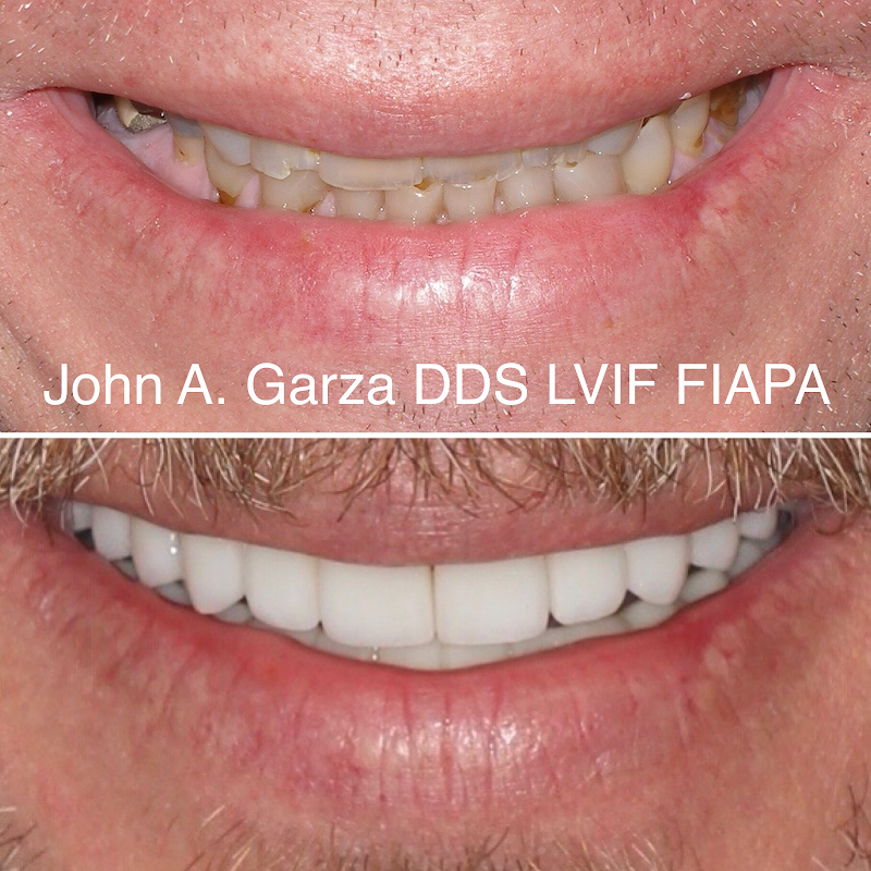 Mountain Smiles Garza PLLC — photo 2