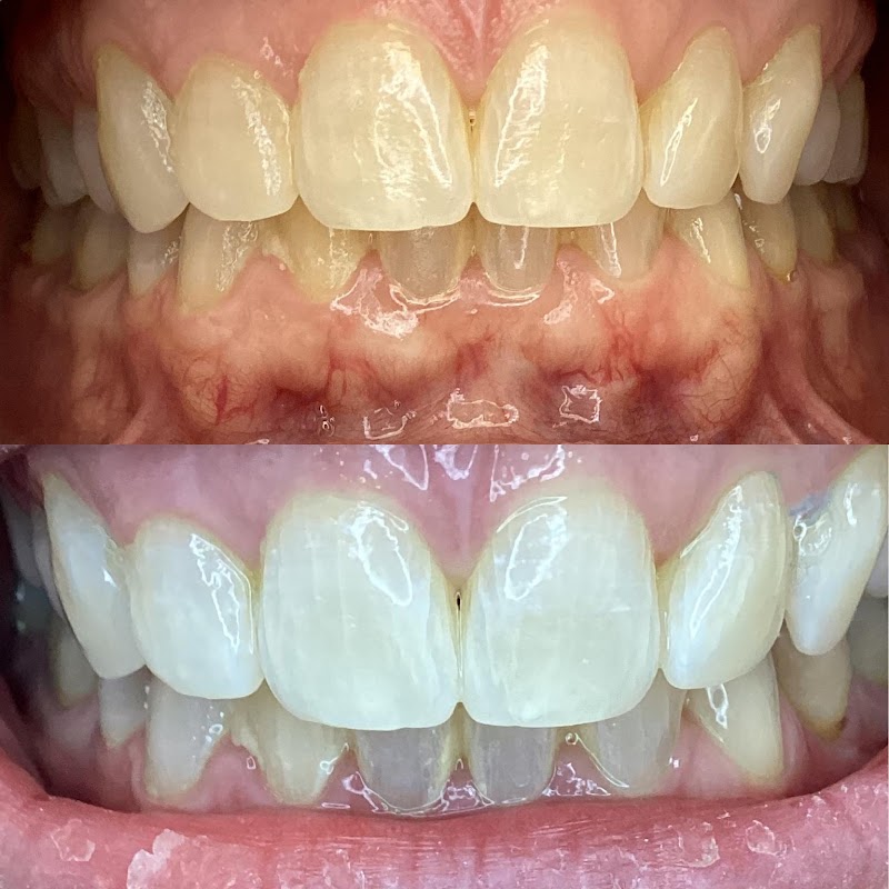 We Whiten Teeth Whitening — featured photo