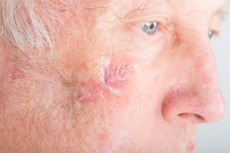 English Dermatology Gilbert — photo 5