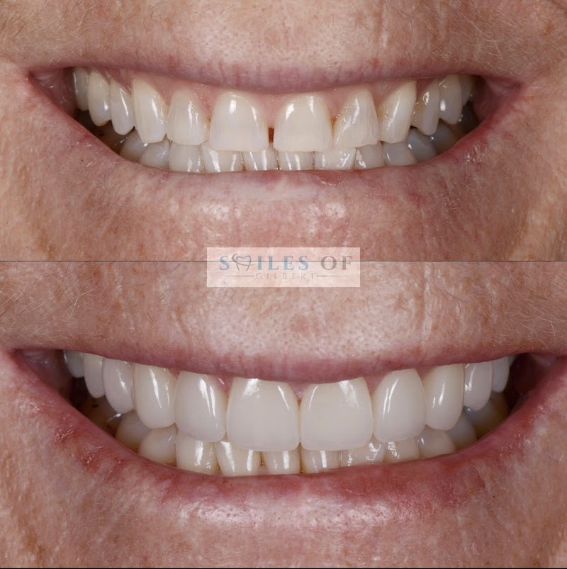 Smiles Of Gilbert Dentistry — photo 2