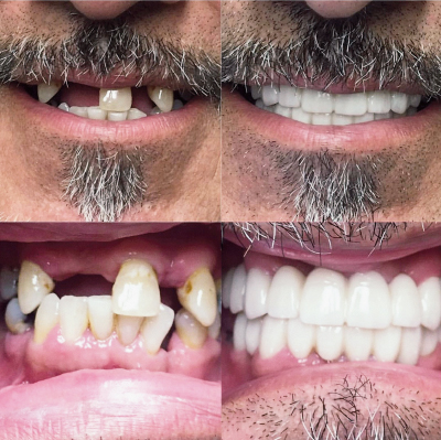 Premier Family Dental Care — photo 2