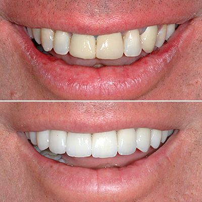 Artistry In Dentistry — photo 2